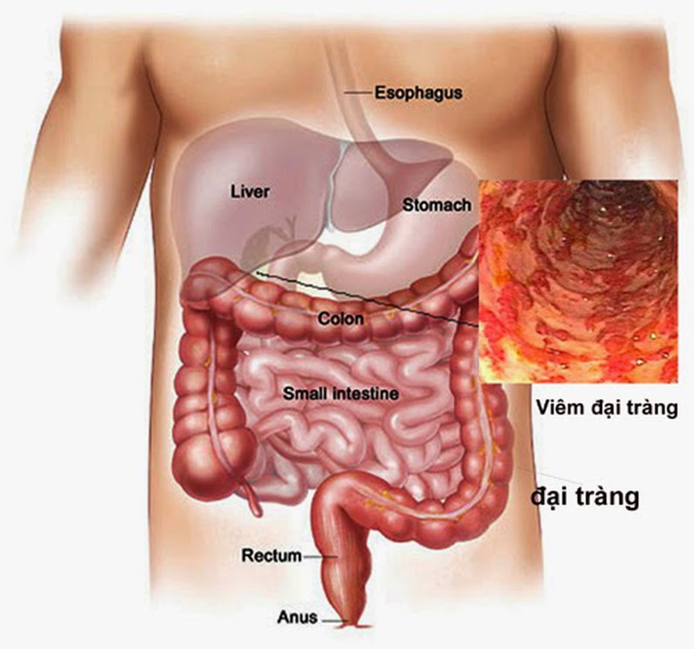 7. Câu hỏi thường gặp về đại tràng bẩn